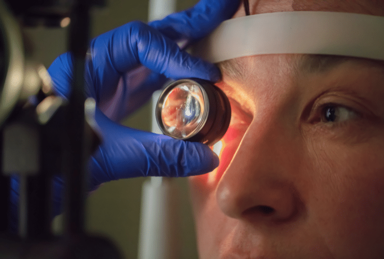 VA Disability Rating for Glaucoma | Veterans Guide